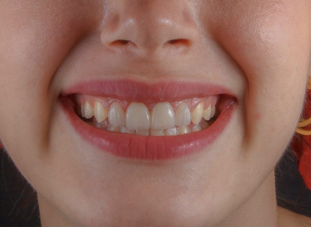 mejor seguro dental España