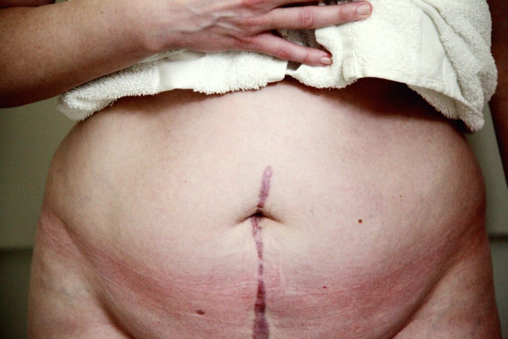 seguro médico cubre cirugía