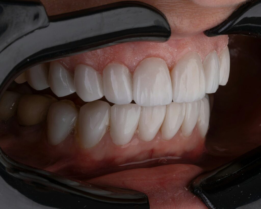 cobertura dental seguro médico