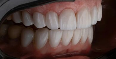 cobertura dental seguro médico
